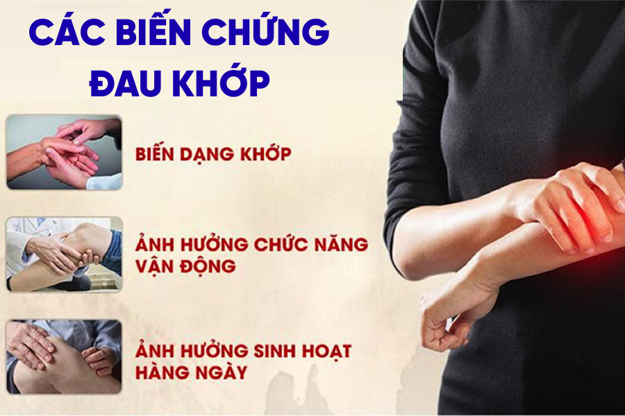Bien Chung Dau Khop Co The Xay Ra Neu Khong Dieu Tri Som