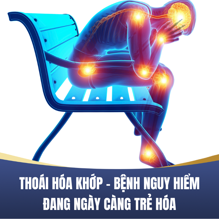 Thoai Hoa Khop Nhung Dieu Ban Can Biet
