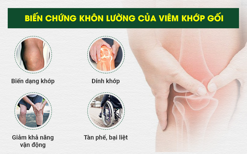Bien Chung Khon Luong Cua Viem Khop