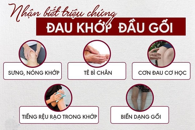 Nhan Biet Trieu Chung Viem Dau Khop