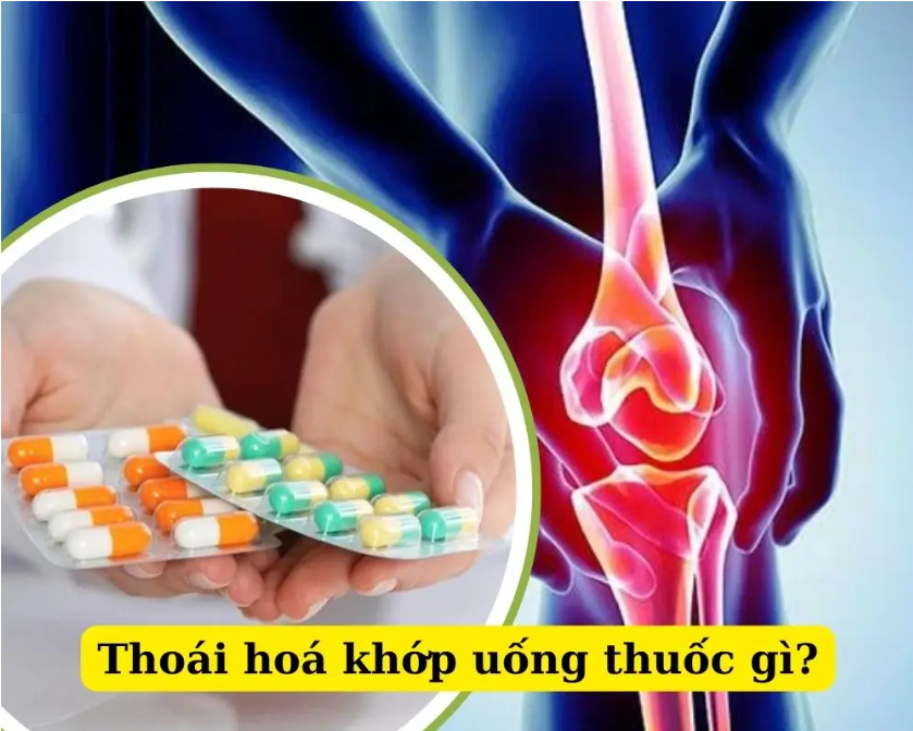 Thuoc Dieu Tri Thoai Hoa Khop