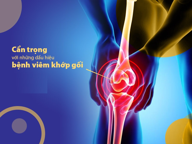 Viem Khop Goi Co Nguy Hiem Khong