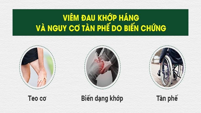Viem Khop Hang Co The Gay Bien Chung Nguy Hiem