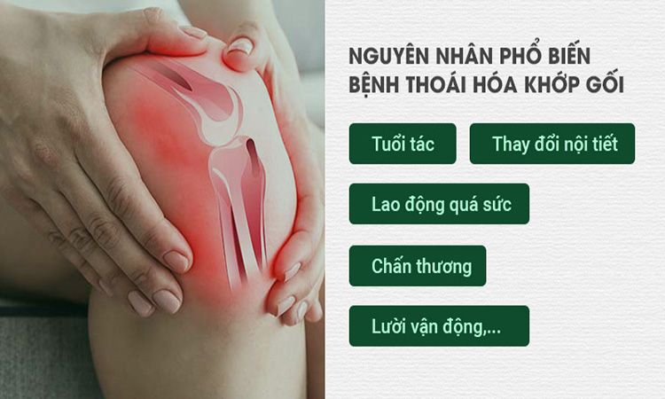 Nguyen Nhan Thoai Hoa Khop Goi