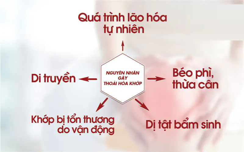 Nguyen Nhan Thoai Hoa Khop Va Viem Khop