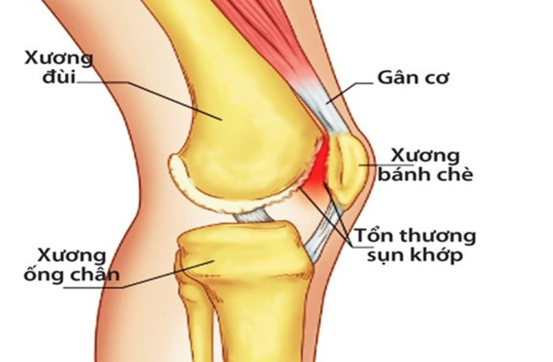 Nguyen Nhan Gay Dau Dau Goi