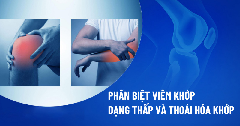 Phan Biet Viem Khop Dang Thap Va Thoai Hoa Khop