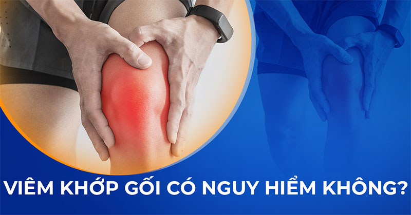 Viem Khop Goi Co Nguy Hiem Khong (1)