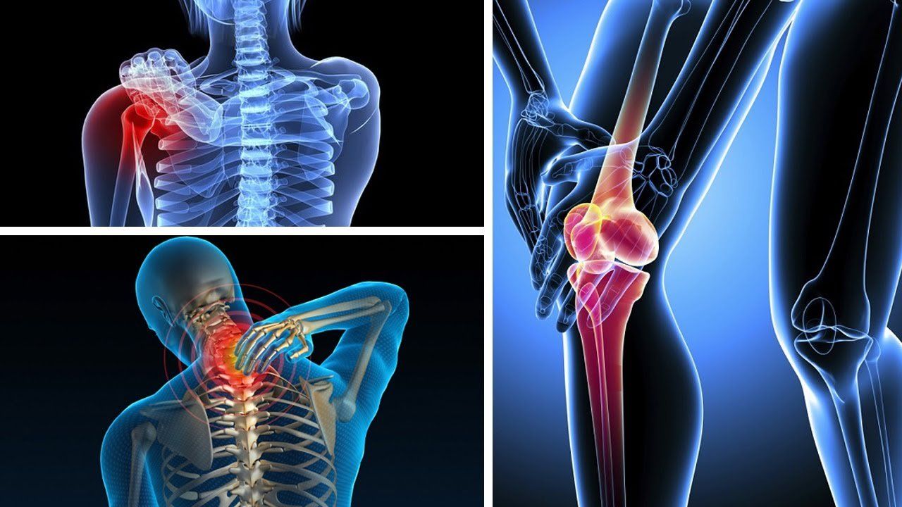 Chữa thoái hóa khớp bằng phương pháp thuốc nam h Chữa thoái hóa khớp bằng phương pháp thuốc nam h
