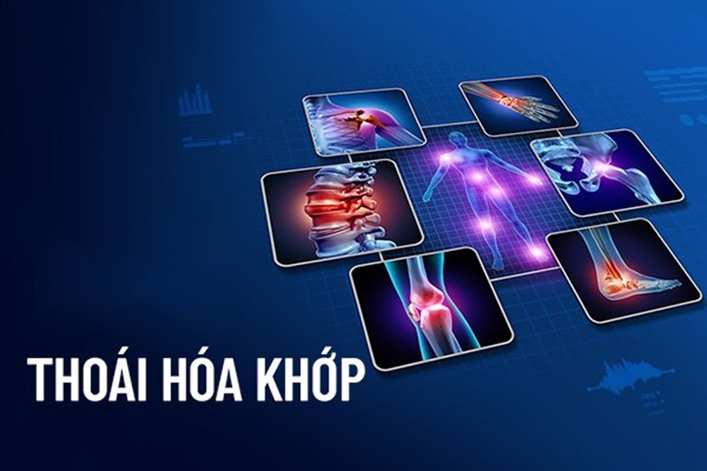 Khám Phá Công Thức Massage Hỗ Trợ Điều Trị Thoái Hóa Khớp - Bí Quyết Vàng Cho Sức Khỏe Xương Khớp