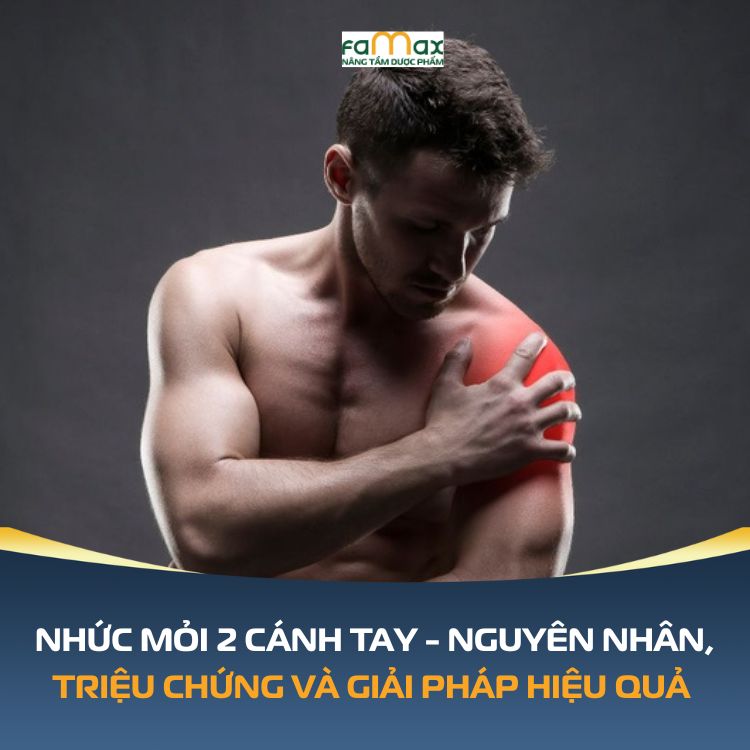 Nhuc Moi 2 Canh Tay Nguyen Nhan Trieu Chung 69211ea34b439.webp