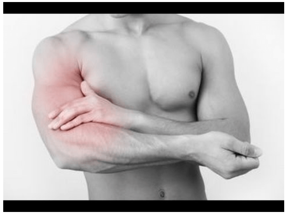 Nhức mỏi 2 cánh tay - nguyên nhân, triệu chứng và giải pháp hiệu quả để chữa dứt điểm Nhức mỏi 2 cánh tay - nguyên nhân, triệu chứng và giải pháp hiệu quả để chữa dứt điểm