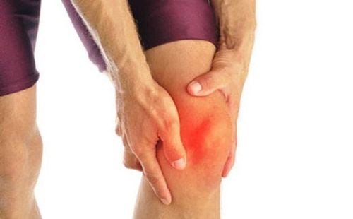 Thoái hóa khớp do chấn thương - Nguyên nhân, cách phòng tránh và điều trị hiệu quả