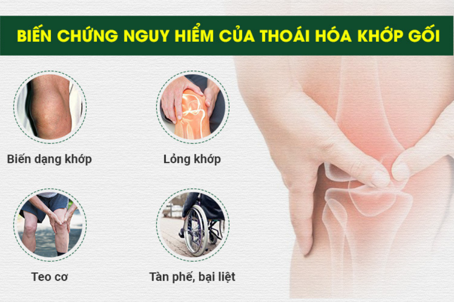Thoái Hoá Khớp Gối Uống Gì - Giải Pháp Cho Sức Khỏe Đau Nhức và Cơ Động