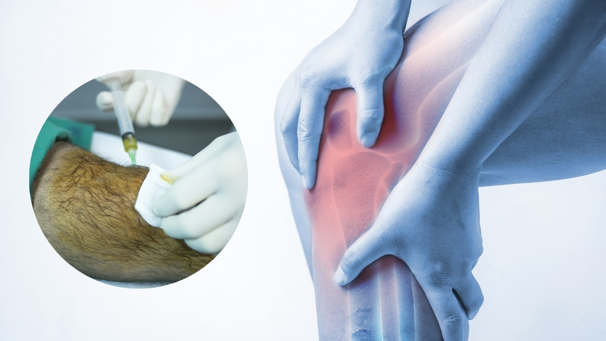 Thoái Hoá Khớp Gối Uống Gì - Giải Pháp Cho Sức Khỏe Đau Nhức và Cơ Động