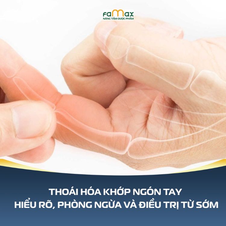 Thoai Hoa Khop Ngon Tay Hieu Ro Phong Ngua 690d65a23a974.webp
