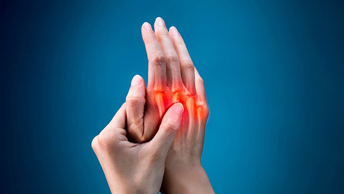 Viêm khớp vảy nến - Bệnh lý ảnh hưởng đến chất lượng cuộc sống của người bệnh