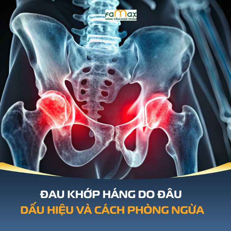 Dau Khop Hang Do Dau Nguyen Nhan Dau Hieu Va Cach Phong Ngua Hieu Qua 69394bf110e92.webp