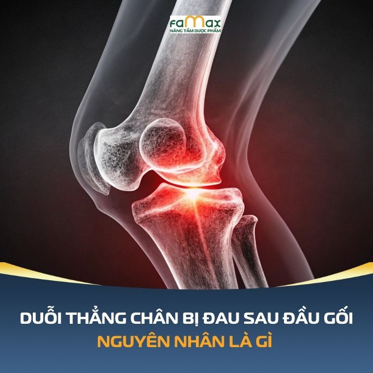 Duoi Thang Chan Bi Dau Sau Dau Goi 6932418debac1.webp