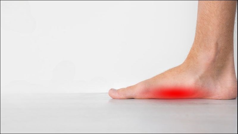 Rất có thể bạn bị viêm gân gót chân mà không biết