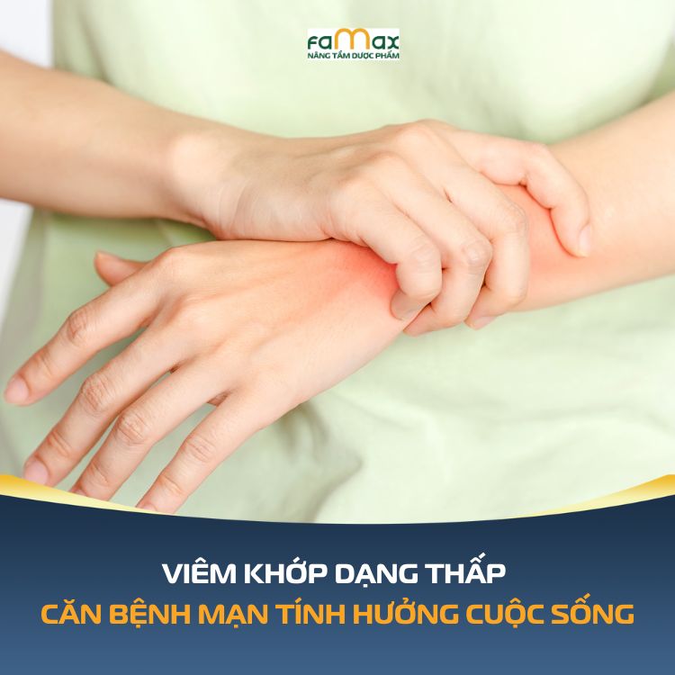 Viem Khop Dang Thap 693cd6d586e08.webp