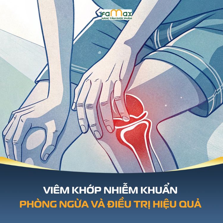Viem Khop Nhiem Khuan Phong Ngua Hieu Qua 6931623db4789.webp